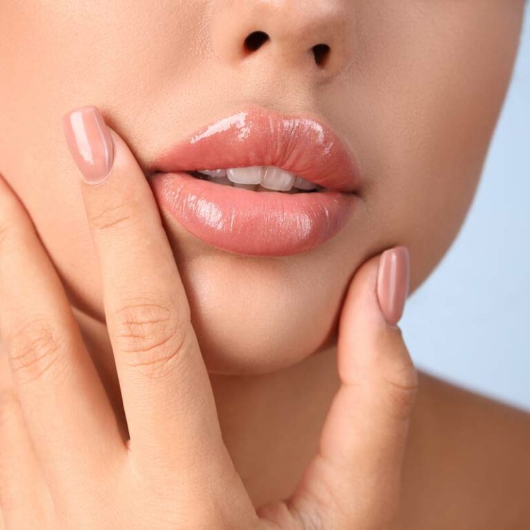 lip lift madrid